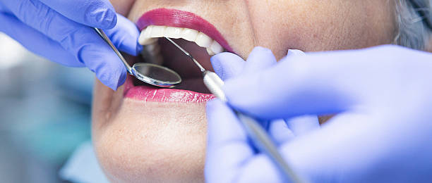 Best Emergency Root Canal Therapy in Manchester, VA